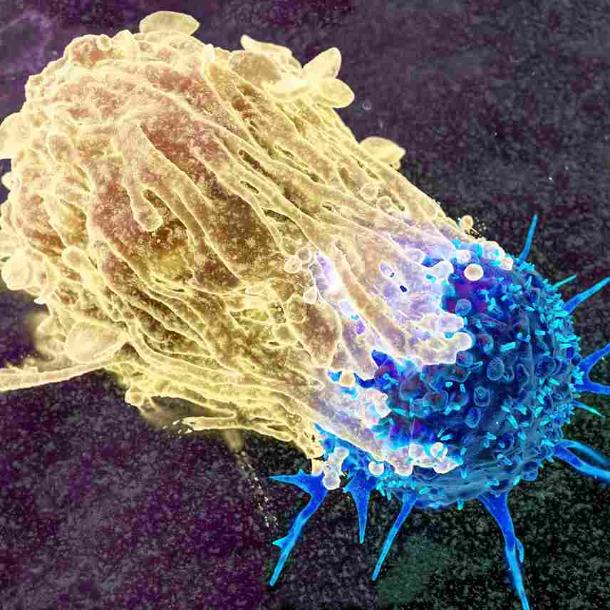 Kenali Kanker Lebih Dekat: Bahaya, Gejala, dan Faktor Risiko yang Perlu Diwaspadai