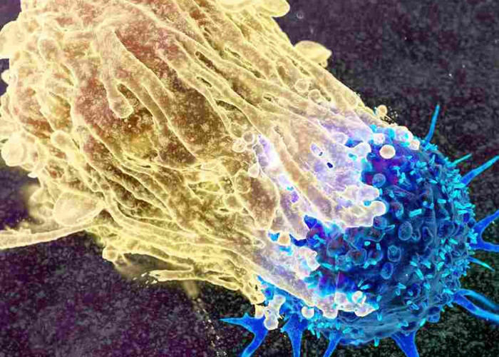 Kenali Kanker Lebih Dekat: Bahaya, Gejala, dan Faktor Risiko yang Perlu Diwaspadai